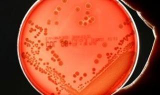 اكتشاف
      بكتيريا
      قادرة
      على
      التظاهر
      بالموت
      حتى
      فى
      بيئة
      معقمة..
      اعرف
      التفاصيل